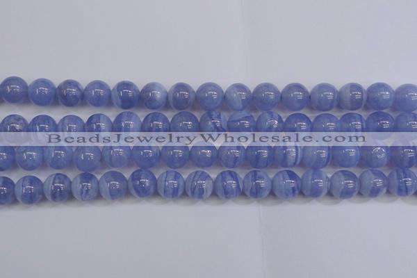 CAG5973 15.5 inches 10mm round blue lace agate beads wholesale